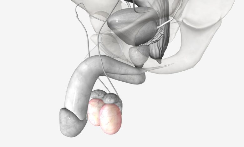Correção microscópica de varicocele