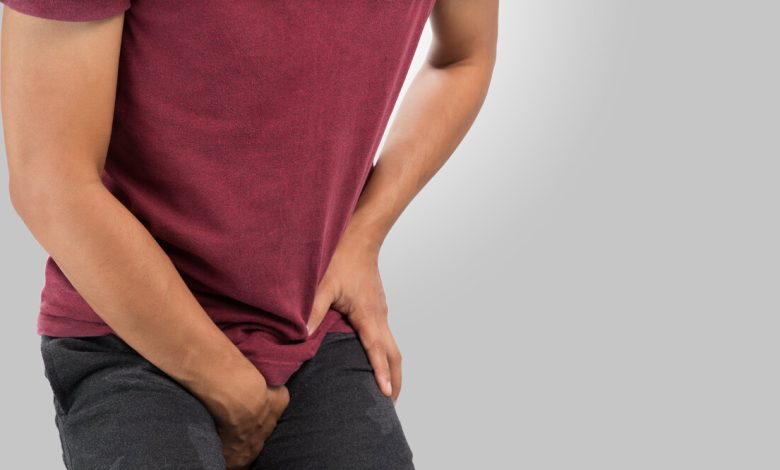 Varicocele
