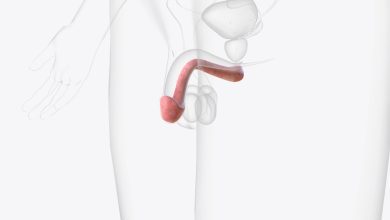 Doença de Peyronie: como tratar?