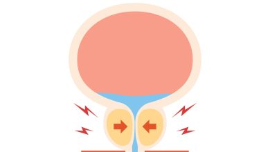Conheça a cirurgia a laser altamente eficaz no tratamento da hiperplasia benigna da próstata