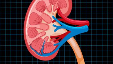 Cálculos renais - quando a cirurgia é de urgência e qual tipo é mais indicado?