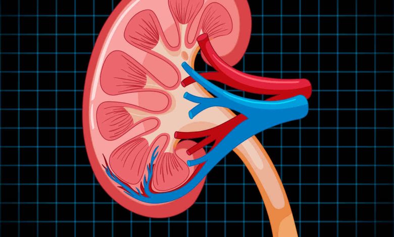 Cálculos renais - quando a cirurgia é de urgência e qual tipo é mais indicado?