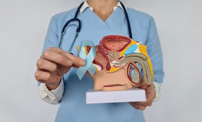 Conheça as técnicas de prostatectomia para o tratamento do câncer de próstata