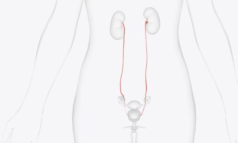 Calculo no ureter: sintomas e tratamentos!